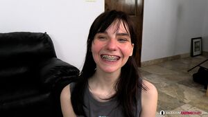 Aurora Pink Cute Braces Anal Freak Backroom Casting Couch